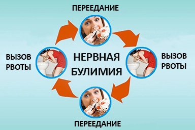 Лечение булимии в Когалыме